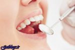 پیشنهاد پرداخت بیمه جهت ایمپلنت ، تاثیر دیابت و دخانیات بر ایمپلنت دندان
